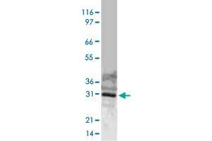 Western blot analysis of full-length, recombinant human BIRC7 using BIRC7 polyclonal antibody  at 1 : 2000.