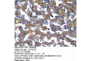 Rabbit Anti-VDAC1 Antibody  Paraffin Embedded Tissue: Human Liver Cellular Data: Hepatocytes Antibody Concentration: 4. (VDAC1 Antikörper  (C-Term))