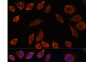 Immunofluorescence analysis of L929 cells using HPS4 Polyclonal Antibody at dilution of 1:100. (HPS4 Antikörper)