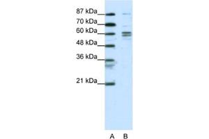 Western Blotting (WB) image for anti-General Transcription Factor IIF, Polypeptide 1, 74kDa (GTF2F1) antibody (ABIN2463819)