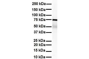 WB Suggested Anti-KHSRP antibody Titration: 1 ug/mL Sample Type: Human heart (KHSRP Antikörper  (Middle Region))