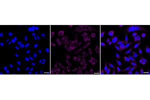 Immunocytochemical staining of HepG2 cells with Melanocortin 5 receptor antibody (ABIN7799355), 1:1,000). (Rekombinanter MC5 Receptor Antikörper)