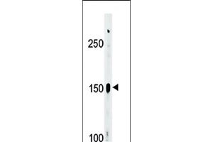 Western blot analysis of Phospho-ABL1/ABL2(439)Antibody Pab (ABIN389506 and ABIN2839561) in  cell line lysate (35 μg/lane). (ABL2 Antikörper  (pTyr393, pTyr439))