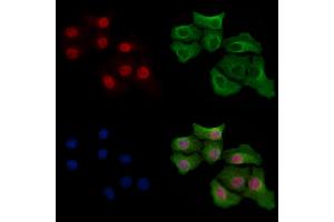 Phospho-ERK1/2 (Thr177/Thr160) Antibody staining Hela cells(heat shock treatment) by IF/ICC. (ERK1/2 Antikörper  (pThr160, pThr177))