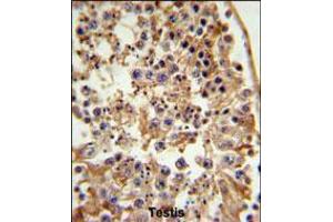 FANCC Antibody IHC analysis in formalin fixed and paraffin embedded testis tissue followed by peroxidase conjugation of the secondary antibody and DAB staining. (FANCC Antikörper  (C-Term))