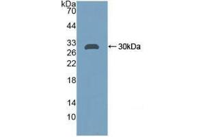 Western blot analysis of recombinant Rat CA2. (CA2 Antikörper)
