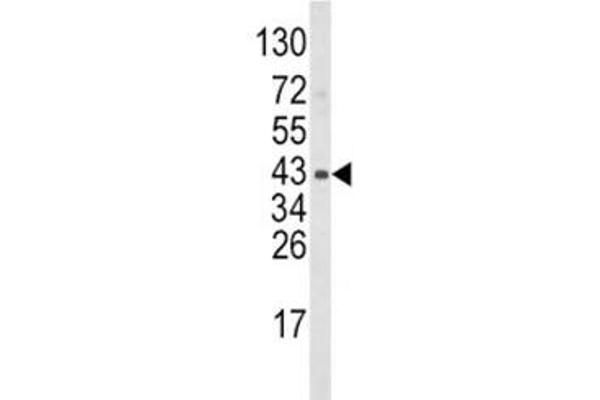 WNT5B Antikörper  (AA 153-182)