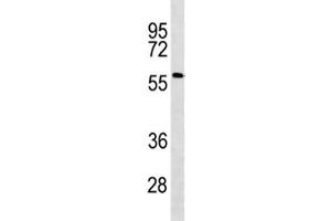 ACSF2 antibody western blot analysis in human Jurkat lysate. (ACSF2 Antikörper  (AA 587-615))