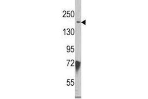 Western Blotting (WB) image for anti-Lysine (K)-Specific Demethylase 6B (Kdm6b) (AA 1-30) antibody (ABIN3031660)