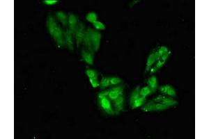 Immunofluorescent analysis of Hela cells using ABIN7169545 at dilution of 1:100 and Alexa Fluor 488-congugated AffiniPure Goat Anti-Rabbit IgG(H+L) (Shugoshin Antikörper  (AA 260-439))