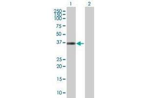 Lane 1: ISY1 transfected lysate ( 33 KDa) Lane 2: Non-transfected lysate. (KIAA1160 293T Cell Transient Overexpression Lysate(Denatured))