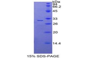 SDS-PAGE analysis of Mouse Histone Deacetylase 6 Protein. (HDAC6 Protein)