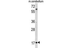 Western Blotting (WB) image for anti-Myelin Associated Oligodendrocyte Basic Protein (MOBP) antibody (ABIN3002875)