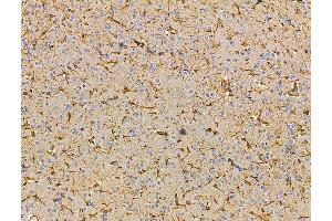 ABIN7096234 and ABIN7100296 at 1/100 staining rat brain tissue by IHC-P.