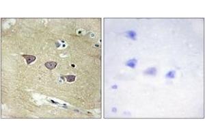 Immunohistochemistry analysis of paraffin-embedded human brain tissue, using CAMK5 Antibody. (CAMKV Antikörper  (AA 211-260))