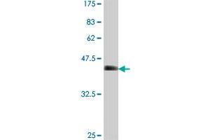 Western Blot detection against Immunogen (35. (SMARCA5 Antikörper  (AA 59-147))