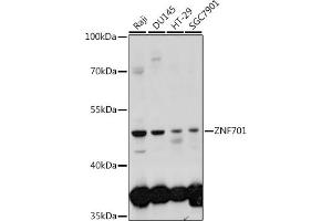 Western blot analysis of extracts of various cell lines, using ZNF701 antibody (ABIN7271523) at 1:1000 dilution. (ZNF701 Antikörper  (AA 100-200))