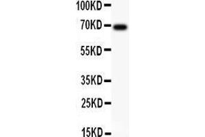 Anti-AFP Picoband antibody,  All lanes: Anti AFP  at 0. (alpha Fetoprotein Antikörper  (AA 378-609))