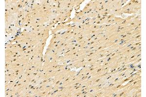 ABIN6261327 and ABIN6278854 at 1/100 staining Rat heart tissue by IHC-P.