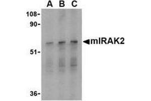 Western blot analysis of IRAK2 in RAW264. (IRAK2 Antikörper  (C-Term))