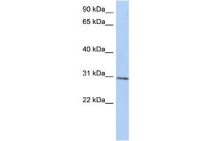 WB Suggested Anti-C14orf172 Antibody Titration:  0. (TRMT61A Antikörper  (N-Term))