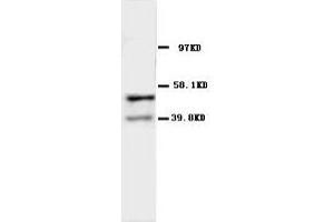 Image no. 2 for anti-Acetylcholine Receptor Subunit alpha (CHRNA1) (N-Term) antibody (ABIN1495052)