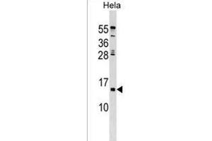 HHLA3 Antibody (Center) (ABIN1538602 and ABIN2849590) western blot analysis in Hela cell line lysates (35 μg/lane). (HHLA3 Antikörper  (AA 75-101))