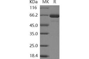 Western Blotting (WB) image for Sphingomyelin phosphodiesterase 1, Acid Lysosomal (SMPD1) protein (His tag) (ABIN7317122)