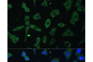 Immunofluorescence analysis of L-929 cells using EIF3D Polyclonal Antibody at dilution of 1:100.