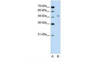 Image no. 2 for anti-Alanine Aminotransferase (ALT) (AA 81-130) antibody (ABIN320979) (ALT Antikörper  (AA 81-130))