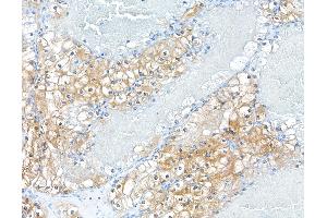 Immunohistochemistry (IHC) image for anti-Macrophage Migration Inhibitory Factor (Glycosylation-Inhibiting Factor) (MIF) (AA 2-115) antibody (ABIN7449455)