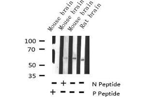 Western blot analysis of Phospho-Tyrosine Hydroxylase (Ser19) expression in various lysates (Tyrosine Hydroxylase Antikörper  (pSer19))