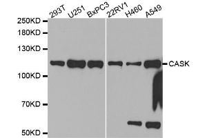Western Blotting (WB) image for anti-Calcium/calmodulin-Dependent serine Protein Kinase (MAGUK Family) (CASK) antibody (ABIN1871447) (CASK Antikörper)