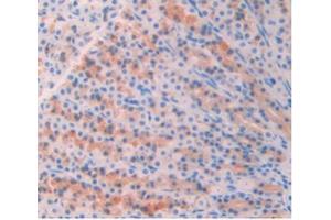 DAB staining on IHC-P;Samples:Rat Stomach Tissue (AZGP1 Antikörper  (AA 18-296))