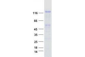 Validation with Western Blot
