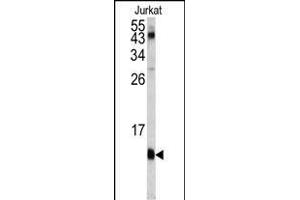 Western blot analysis of FKBP1A antibody (C-term) (ABIN1882082 and ABIN2841885) in Jurkat cell line lysates (35 μg/lane). (FKBP1A Antikörper  (C-Term))
