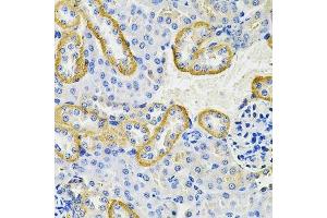 Immunohistochemistry (Paraffin-embedded Sections) (IHC (p)) image for anti-Keratin 20 (KRT20) (AA 245-424) antibody (ABIN3020782)