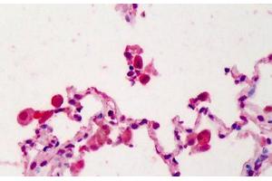 Human Lung: Formalin-Fixed, Paraffin-Embedded (FFPE) (IL22 Receptor alpha 1 Antikörper  (N-Term))