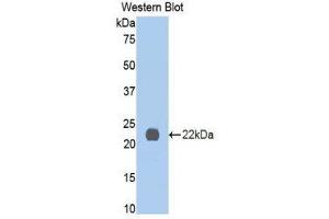 Western Blotting (WB) image for anti-Interleukin 13 Receptor, alpha 1 (IL13RA1) (AA 201-360) antibody (ABIN3206304) (IL13 Receptor alpha 1 Antikörper  (AA 201-360))
