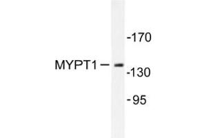 Image no. 1 for anti-Myosin Phosphatase, Target Subunit 1 (PPP1R12A) antibody (ABIN272042) (PPP1R12A Antikörper)