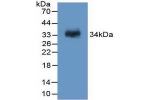 Detection of Recombinant F13A1, Rat using Polyclonal Antibody to Coagulation Factor XIII A1 Polypeptide (F13A1) (F13A1 Antikörper  (AA 140-377))