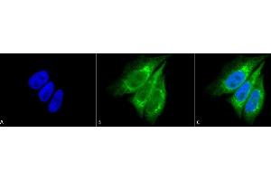 Immunocytochemistry/Immunofluorescence analysis using Rabbit Anti-KDEL Polyclonal Antibody (ABIN863187 and ABIN863188). (KDEL Antikörper)