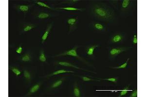 Immunofluorescence (IF) image for anti-Angiogenic Factor with G Patch and FHA Domains 1 (AGGF1) (AA 1-714) antibody (ABIN949412)