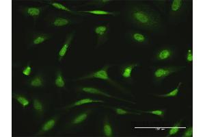 Immunofluorescence of purified MaxPab antibody to AGGF1 on HeLa cell. (AGGF1 Antikörper  (AA 1-714))