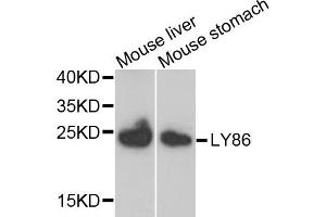 Western blot analysis of extracts of mouse liver and mouse stomach, using LY86 antibody. (LY86 Antikörper)