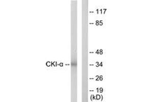 Western blot analysis of extracts from HeLa cells, using CKI-alpha Antibody. (CSNK1A1 Antikörper  (AA 126-175))