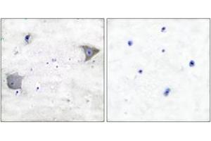 Immunohistochemistry analysis of paraffin-embedded human brain tissue, using PDGFR alpha Antibody. (PDGFRA Antikörper  (AA 1031-1080))