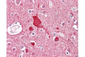 Anti-ABCA2 antibody IHC staining of human brain, cortex. (ABCA2 Antikörper  (AA 2363-2376))
