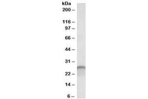 Western blot testing of human cerebellum lysate with Calbindin 1 antibody at 0. (CALB1 Antikörper)
