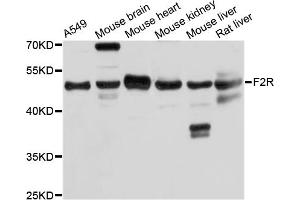 Western blot analysis of extracts of various cell lines, using F2R antibody (ABIN5974987) at 1/1000 dilution. (PAR1 Antikörper)